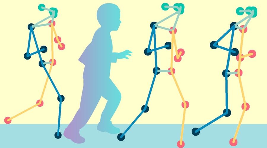 هوش مصنوعی در حال تشخیص بیماران حرکتی